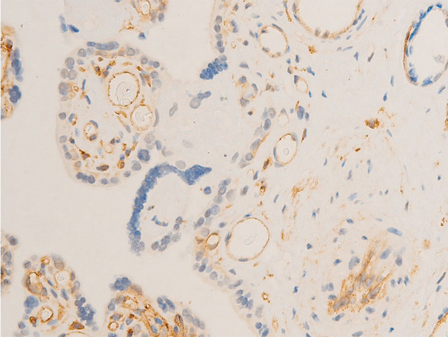 SYK Antibody - 1:100 staining human Placenta tissue by IHC-P. The tissue was formaldehyde fixed and a heat mediated antigen retrieval step in citrate buffer was performed. The tissue was then blocked and incubated with the antibody for 1.5 hours at 22°C. An HRP conjugated goat anti-rabbit antibody was used as the secondary.