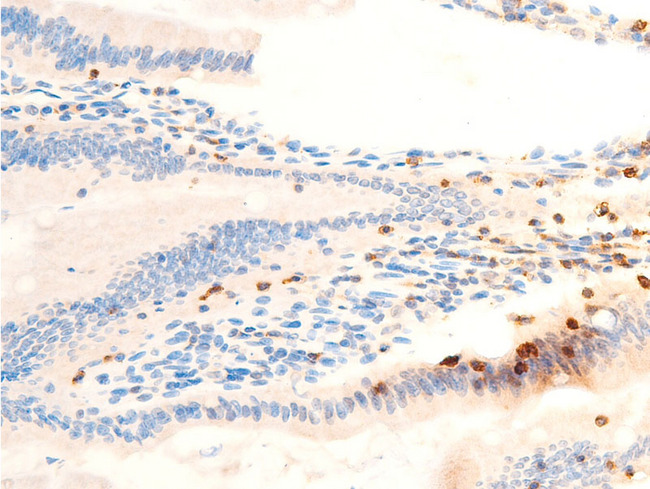 SYK Antibody - 1:100 staining rat Intestinal tissue by IHC-P. The tissue was formaldehyde fixed and a heat mediated antigen retrieval step in citrate buffer was performed. The tissue was then blocked and incubated with the antibody for 1.5 hours at 22°C. An HRP conjugated goat anti-rabbit antibody was used as the secondary.