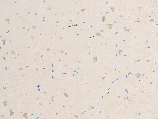 SYK Antibody - 1:100 staining human heart tissue by IHC-P. The tissue was formaldehyde fixed and a heat mediated antigen retrieval step in citrate buffer was performed. The tissue was then blocked and incubated with the antibody for 1.5 hours at 22°C. An HRP conjugated goat anti-rabbit antibody was used as the secondary.