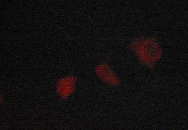 SYK Antibody - Staining LOVO cells by IF/ICC. The samples were fixed with PFA and permeabilized in 0.1% saponin prior to blocking in 10% serum for 45 min at 37°C. The primary antibody was diluted 1/400 and incubated with the sample for 1 hour at 37°C. A Alexa Fluor® 594 conjugated goat polyclonal to rabbit IgG (H+L), diluted 1/600 was used as secondary antibody.