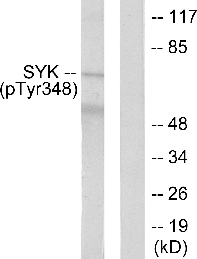 SYK Antibody - Western blot analysis of lysates from COS7 cells treated with EGF 200ng/ml 30', using SYK (Phospho-Tyr348) Antibody. The lane on the right is blocked with the phospho peptide.