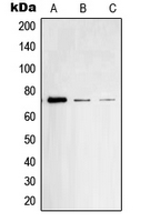 SYK Antibody - Western blot analysis of SYK (pY348) expression in Raji (A); THP1 (B); mouse spleen (C) whole cell lysates.