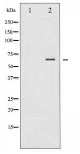 SYK Antibody - Western blot of SYK phosphorylation expression in EGF treated COS7 whole cell lysates,The lane on the left is treated with the antigen-specific peptide.