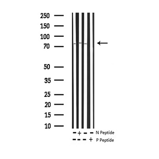 SYK Antibody - Western blot analysis of Phospho-SYK (Tyr348) expression in various lysates