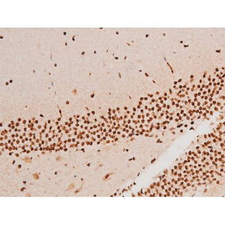 SYK Antibody - 1:200 staining mouse brain tissue by IHC-P. The tissue was formaldehyde fixed and a heat mediated antigen retrieval step in citrate buffer was performed. The tissue was then blocked and incubated with the antibody for 1.5 hours at 22°C. An HRP conjugated goat anti-rabbit antibody was used as the secondary.