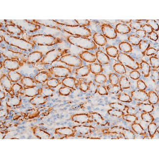 SYK Antibody - 1:200 staining mouse kidney tissue by IHC-P. The tissue was formaldehyde fixed and a heat mediated antigen retrieval step in citrate buffer was performed. The tissue was then blocked and incubated with the antibody for 1.5 hours at 22°C. An HRP conjugated goat anti-rabbit antibody was used as the secondary.
