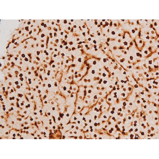 SYK Antibody - 1:200 staining mouse liver tissue by IHC-P. The tissue was formaldehyde fixed and a heat mediated antigen retrieval step in citrate buffer was performed. The tissue was then blocked and incubated with the antibody for 1.5 hours at 22°C. An HRP conjugated goat anti-rabbit antibody was used as the secondary.