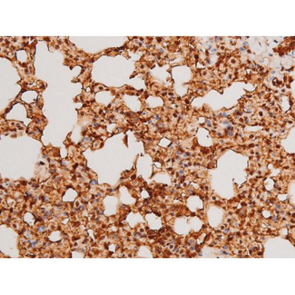SYK Antibody - 1:200 staining mouse lung tissue by IHC-P. The tissue was formaldehyde fixed and a heat mediated antigen retrieval step in citrate buffer was performed. The tissue was then blocked and incubated with the antibody for 1.5 hours at 22°C. An HRP conjugated goat anti-rabbit antibody was used as the secondary.