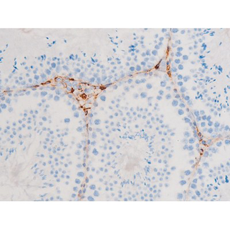 SYK Antibody - 1:200 staining mouse testis tissue by IHC-P. The tissue was formaldehyde fixed and a heat mediated antigen retrieval step in citrate buffer was performed. The tissue was then blocked and incubated with the antibody for 1.5 hours at 22°C. An HRP conjugated goat anti-rabbit antibody was used as the secondary.