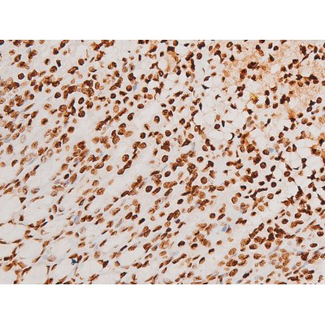 SYK Antibody - 1:200 staining rat ganstric tissue by IHC-P. The tissue was formaldehyde fixed and a heat mediated antigen retrieval step in citrate buffer was performed. The tissue was then blocked and incubated with the antibody for 1.5 hours at 22°C. An HRP conjugated goat anti-rabbit antibody was used as the secondary.