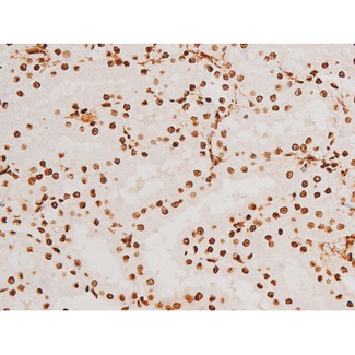 SYK Antibody - 1:200 staining rat kidney tissue by IHC-P. The tissue was formaldehyde fixed and a heat mediated antigen retrieval step in citrate buffer was performed. The tissue was then blocked and incubated with the antibody for 1.5 hours at 22°C. An HRP conjugated goat anti-rabbit antibody was used as the secondary.