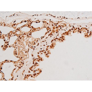SYK Antibody - 1:200 staining rat lung tissue by IHC-P. The tissue was formaldehyde fixed and a heat mediated antigen retrieval step in citrate buffer was performed. The tissue was then blocked and incubated with the antibody for 1.5 hours at 22°C. An HRP conjugated goat anti-rabbit antibody was used as the secondary.