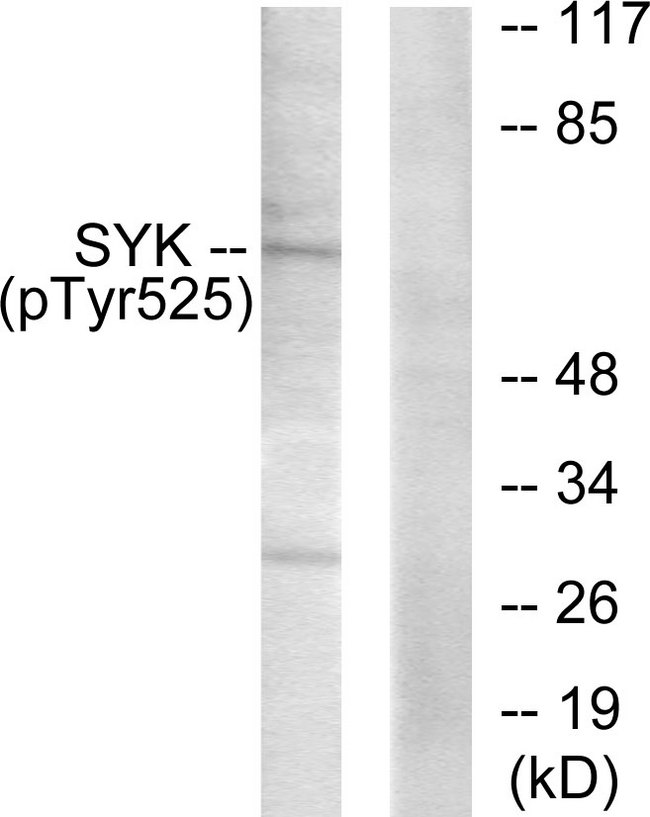 SYK Antibody - Western blot analysis of lysates from A549 cells, using SYK (Phospho-Tyr525) Antibody. The lane on the right is blocked with the phospho peptide.