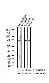SYK Antibody - Western blot analysis of AKT3 expression in mouse kidney lysate
