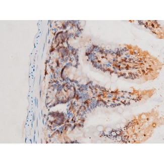 SYK Antibody - 1:200 staining mouse intestinal tissue by IHC-P. The tissue was formaldehyde fixed and a heat mediated antigen retrieval step in citrate buffer was performed. The tissue was then blocked and incubated with the antibody for 1.5 hours at 22°C. An HRP conjugated goat anti-rabbit antibody was used as the secondary.