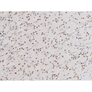 SYK Antibody - 1:200 staining rat ganstric tissue by IHC-P. The tissue was formaldehyde fixed and a heat mediated antigen retrieval step in citrate buffer was performed. The tissue was then blocked and incubated with the antibody for 1.5 hours at 22°C. An HRP conjugated goat anti-rabbit antibody was used as the secondary.
