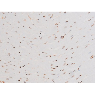 SYK Antibody - 1:200 staining rat heart tissue by IHC-P. The tissue was formaldehyde fixed and a heat mediated antigen retrieval step in citrate buffer was performed. The tissue was then blocked and incubated with the antibody for 1.5 hours at 22°C. An HRP conjugated goat anti-rabbit antibody was used as the secondary.