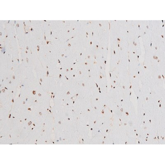 SYK Antibody - 1:200 staining rat heart tissue by IHC-P. The tissue was formaldehyde fixed and a heat mediated antigen retrieval step in citrate buffer was performed. The tissue was then blocked and incubated with the antibody for 1.5 hours at 22°C. An HRP conjugated goat anti-rabbit antibody was used as the secondary.