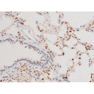 SYK Antibody - 1:200 staining rat lung tissue by IHC-P. The tissue was formaldehyde fixed and a heat mediated antigen retrieval step in citrate buffer was performed. The tissue was then blocked and incubated with the antibody for 1.5 hours at 22°C. An HRP conjugated goat anti-rabbit antibody was used as the secondary.