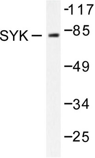 SYK Antibody - Western blot of SYK (P342) pAb in extracts from K562 cells treated with UV 15'.