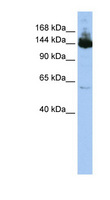 SYMPK / Symplekin Antibody - SYMPK / Symplekin antibody Western blot of HepG2 cell lysate. This image was taken for the unconjugated form of this product. Other forms have not been tested.
