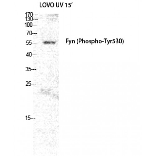 SYN / FYN Antibody - Western blot of Phospho-Fyn (Y530) antibody