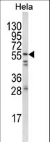 SYN / FYN Antibody - Western blot of FYN Antibody in HeLa cell line lysates (35 ug/lane). FYN (arrow) was detected using the purified antibody.
