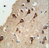 SYN / FYN Antibody - Formalin-fixed and paraffin-embedded human brain tissue reacted with FYN Antibody , which was peroxidase-conjugated to the secondary antibody, followed by DAB staining. This data demonstrates the use of this antibody for immunohistochemistry; clinical relevance has not been evaluated.