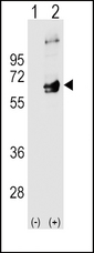SYN / FYN Antibody - Western blot of FYN (arrow) using rabbit polyclonal FYN Antibody. 293 cell lysates (2 ug/lane) either nontransfected (Lane 1) or transiently transfected (Lane 2) with the FYN gene.