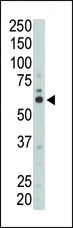 SYN / FYN Antibody - Western blot of anti-FYN antibody in mouse liver tissue lysate. FYN (arrow) was detected using purified antibody. Secondary HRP-anti-rabbit was used for signal visualization with chemiluminescence.