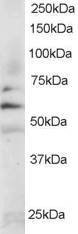 SYN / FYN Antibody - Staining (0.2 ug/ml) of Jurkat lysate (RIPA buffer, 35 ug total protein per lane). Primary incubated for 1 hour. Detected using chemiluminescence.