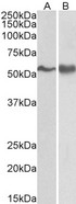 SYN / FYN Antibody - Goat Anti-FYN Antibody (0.3µg/ml) staining of A431 (A) and Jurkat lysate (B) (35µg protein in RIPA buffer). Primary incubation was 1 hour. Detected by chemiluminescencence.