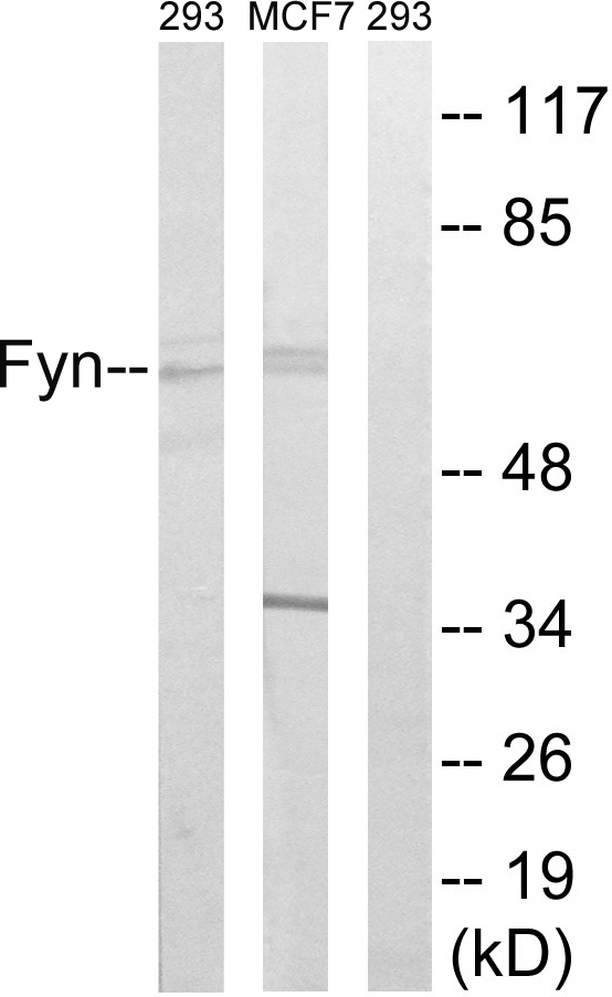 SYN / FYN Antibody - Western blot analysis of lysates from MCF-7 and 293 cells, using Fyn Antibody. The lane on the right is blocked with the synthesized peptide.