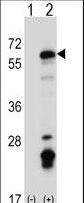 SYN / FYN Antibody - Western blot of Fyn (arrow) using rabbit polyclonal Mouse Fyn Antibody. 293 cell lysates (2 ug/lane) either nontransfected (Lane 1) or transiently transfected (Lane 2) with the Fyn gene.