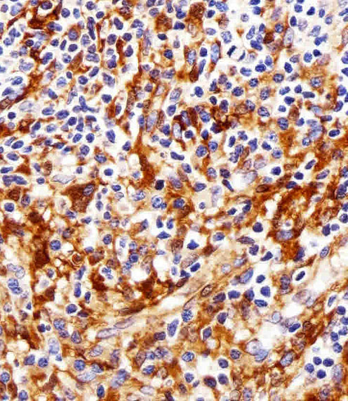SYN / FYN Antibody - Immunohistochemical of paraffin-embedded H. tonsil section using FYN. Antibody was diluted at 1:25 dilution. A peroxidase-conjugated goat anti-rabbit IgG at 1:400 dilution was used as the secondary antibody, followed by DAB staining.