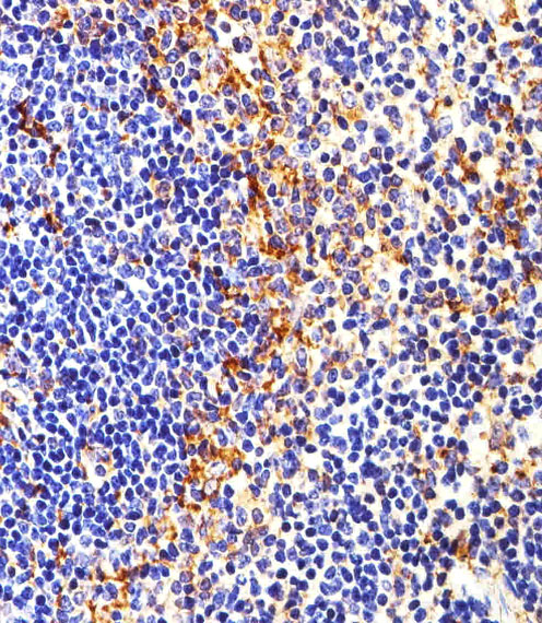 SYN / FYN Antibody - Immunohistochemical of paraffin-embedded M. spleen section using FYN. Antibody was diluted at 1:25 dilution. A peroxidase-conjugated goat anti-rabbit IgG at 1:400 dilution was used as the secondary antibody, followed by DAB staining.
