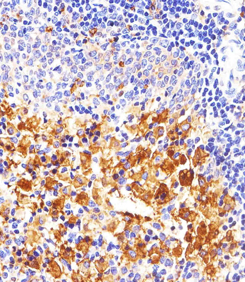 SYN / FYN Antibody - Immunohistochemical of paraffin-embedded R. spleen section using FYN. Antibody was diluted at 1:25 dilution. A peroxidase-conjugated goat anti-rabbit IgG at 1:400 dilution was used as the secondary antibody, followed by DAB staining.