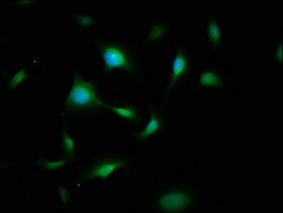 SYN / FYN Antibody - Immunofluorescence staining of U251 cells with FYN Antibody at 1:200, counter-stained with DAPI. The cells were fixed in 4% formaldehyde, permeabilized using 0.2% Triton X-100 and blocked in 10% normal Goat Serum. The cells were then incubated with the antibody overnight at 4°C. The secondary antibody was Alexa Fluor 488-congugated AffiniPure Goat Anti-Rabbit IgG(H+L).
