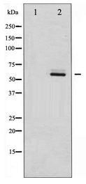 SYN / FYN Antibody - Western blot of Fyn expression in 293 whole cell lysates,The lane on the left is treated with the antigen-specific peptide.