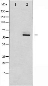 SYN / FYN Antibody - Western blot analysis of Fyn expression in 293 whole cells lysates. The lane on the left is treated with the antigen-specific peptide.