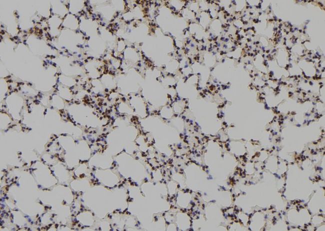 SYN / FYN Antibody - 1:100 staining mouse lung tissue by IHC-P. The sample was formaldehyde fixed and a heat mediated antigen retrieval step in citrate buffer was performed. The sample was then blocked and incubated with the antibody for 1.5 hours at 22°C. An HRP conjugated goat anti-rabbit antibody was used as the secondary.