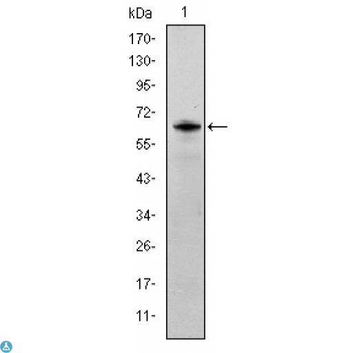 SYN / FYN Antibody - Western Blot (WB) analysis using Fyn Monoclonal Antibody against HeLa cell lysate.