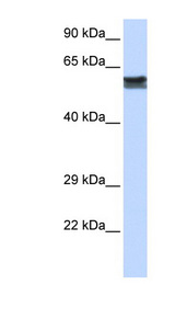 SYN / FYN Antibody - FYN antibody Western blot of Fetal Heart lysate. This image was taken for the unconjugated form of this product. Other forms have not been tested.
