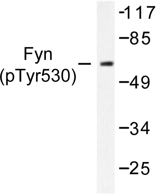 SYN / FYN Antibody - Western blot of p-Fyn (Y530) pAb in extracts from LOVO cells treated with UV.