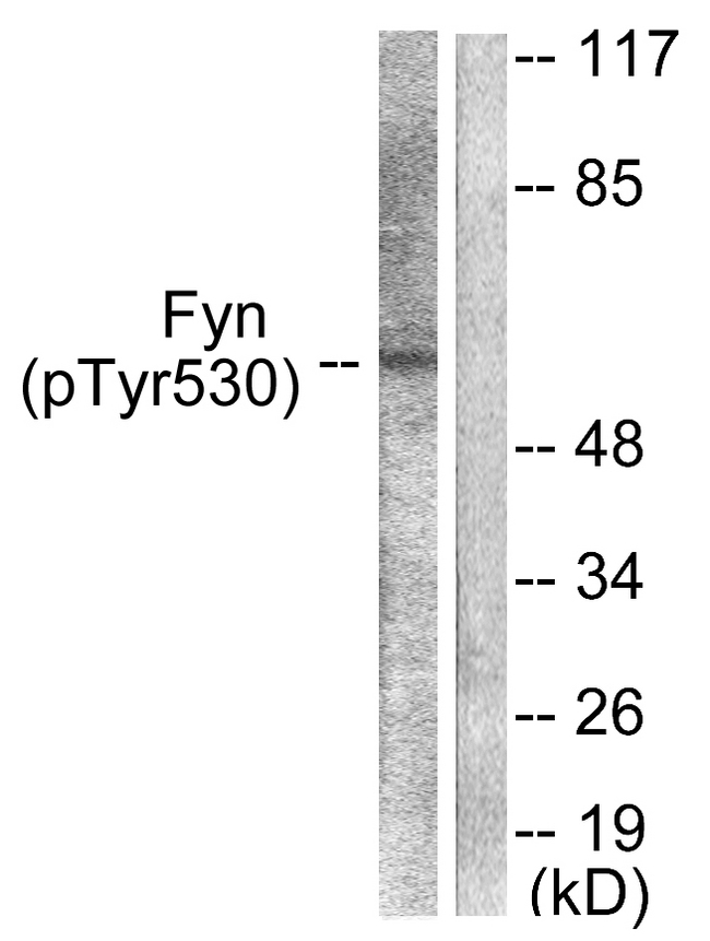 SYN / FYN Antibody - Western blot analysis of lysates from 293 cells treated with H2O2 100uM 15', using Fyn (Phospho-Tyr530) Antibody. The lane on the right is blocked with the phospho peptide.