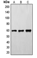 SYN / FYN Antibody - Western blot analysis of FYN (pY530) expression in HeLa (A); mouse brain (B); rat brain (C) whole cell lysates.