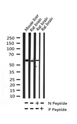 SYN / FYN Antibody - Western blot analysis of Src expression in various lysates