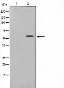 SYN / FYN Antibody - Western blot analysis of Fyn phosphorylation expression in H2O2 treated 293 whole cells lysates. The lane on the left is treated with the antigen-specific peptide.