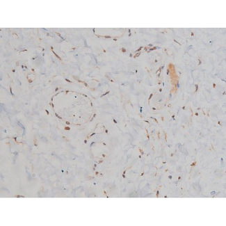 SYN / FYN Antibody - 1:200 staining human esophagus tissue by IHC-P. The tissue was formaldehyde fixed and a heat mediated antigen retrieval step in citrate buffer was performed. The tissue was then blocked and incubated with the antibody for 1.5 hours at 22°C. An HRP conjugated goat anti-rabbit antibody was used as the secondary.
