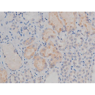 SYN / FYN Antibody - 1:200 staining human kidney tissue by IHC-P. The tissue was formaldehyde fixed and a heat mediated antigen retrieval step in citrate buffer was performed. The tissue was then blocked and incubated with the antibody for 1.5 hours at 22°C. An HRP conjugated goat anti-rabbit antibody was used as the secondary.